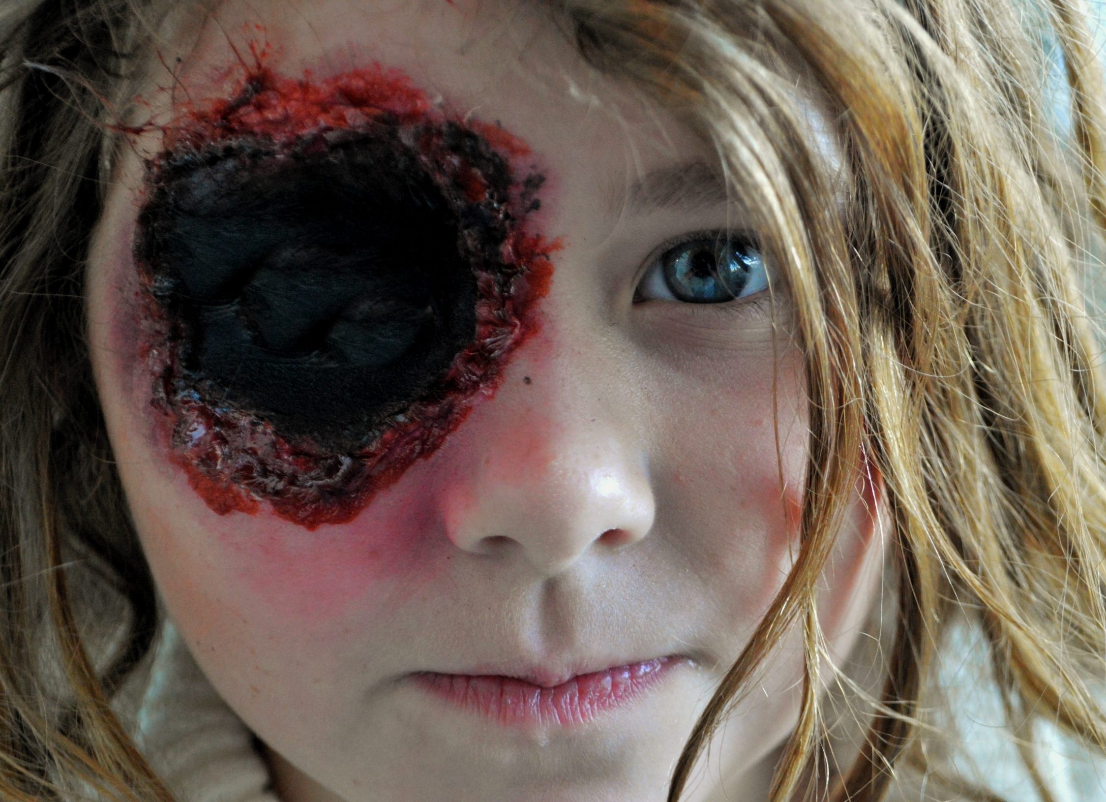 Girl with Missing Bloody Eye